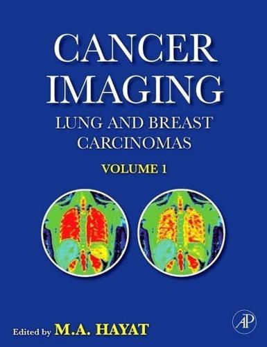 Cancer Imaging By:Hayat, M. A. Eur:336,57 Ден2:8999