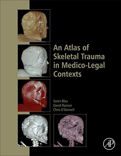 An Atlas of Skeletal Trauma in Medico-Legal Contexts By:Blau, Soren Eur:299.17 Ден1:14199