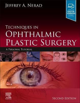 Techniques in Ophthalmic Plastic Surgery : A Personal Tutorial By:Nerad, Jeffrey A. Eur:422,75 Ден1:27499