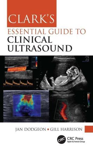 Clark's Essential Guide to Clinical Ultrasound - Clark's Companion Essential Guides By:Harrison, Gill Eur:34,13 Ден1:2199