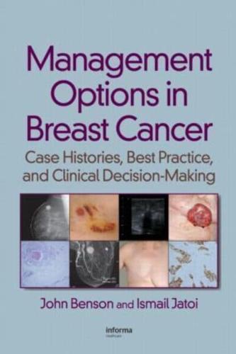 Management Options in Breast Cancer By:Jatoi, Ismail Eur:39,01 Ден2:8999