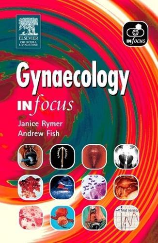 Gynaecology - In Focus By:Fish, Andrew N. J. Eur:56,89 Ден2:1599