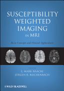 Susceptibility Weighted Imaging in MRI By: Eur:141,45 Ден1:2999