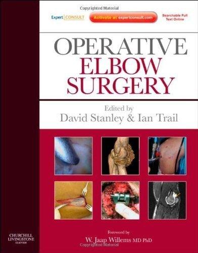 Operative Elbow Surgery : Expert Consult: Online and Print By:Stanley, David Eur:123,56 Ден2:14499