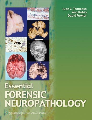 Essential Forensic Neuropathology By:Troncosco, Juan C. Eur:611.37 Ден1:11799
