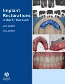 Implant Restorations By:Drago, Carl Eur:79,66 Ден2:1499