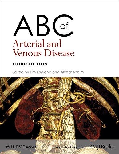 ABC of Arterial and Venous Disease By:England, Tim Eur:32,50 Ден2:2399