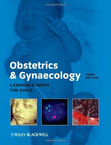 Obstetrics and Gynaecology By:Impey, Lawrence Eur:151,20 Ден2:2399