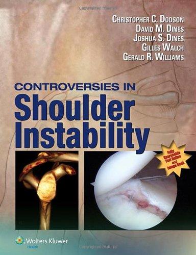 Controversies in Shoulder Instability By:Dodson, Christopher Eur:349,58 Ден1:14399