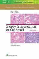 Biopsy Interpretation of the Breast By:Schnitt, Stuart J. Eur:169,09  Ден3:10399