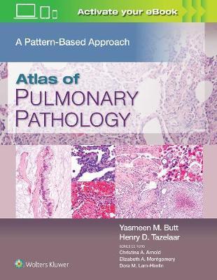 Atlas of Pulmonary Pathology : A Pattern Based Approach By:Butt, Yasmeen Mahmood Eur:235,76 Ден1:14299