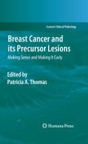 Breast Cancer and its Precursor Lesions By: Eur:175,59 Ден1:5799