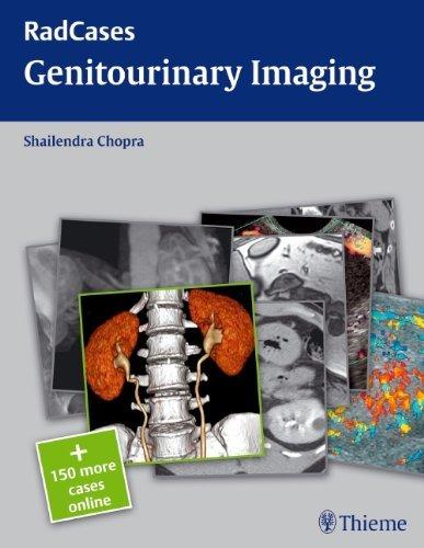 Radcases Genitourinary Imaging By:Chopra, Shai Lendra Eur:336,57 Ден1:3399
