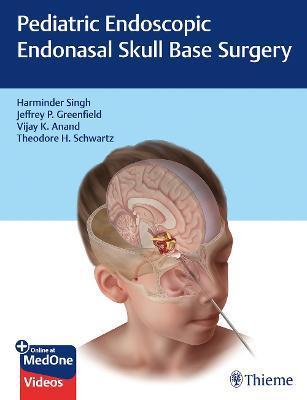 Pediatric Endoscopic Endonasal Skull Base Surgery By:Singh, Harminder Eur:325,19 Ден1:8699