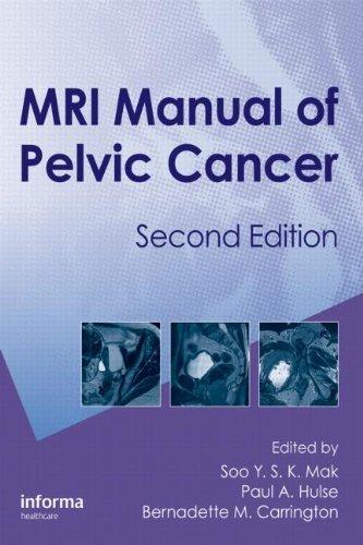 MRI Manual of Pelvic Cancer,Second Edition By:Mak, Soo Eur:95,92 Ден2:8699