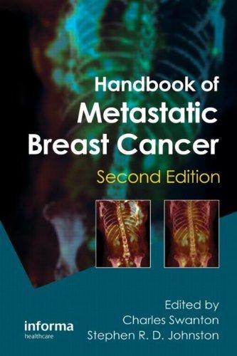 Handbook of Metastatic Breast Cancer By:Swanton, Charles Eur:65,02 Ден2:5899