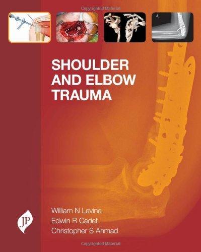 Shoulder and Elbow Trauma By:Levine, William N. Eur:531,69 Ден2:5699