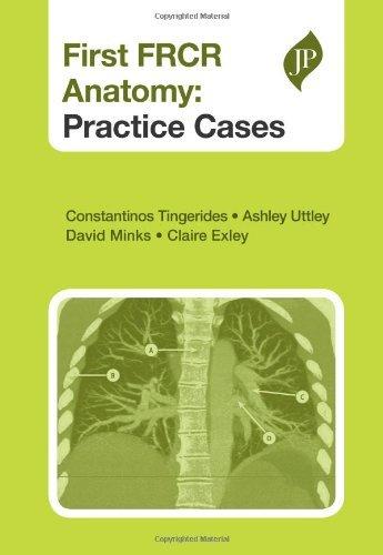 First FRCR Anatomy : Practice Cases By:Tingerides, Constantinos Eur:55,27 Ден2:2399