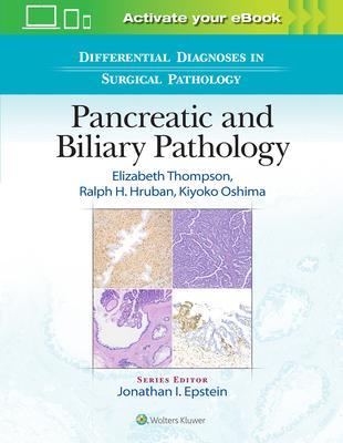 Differential Diagnoses in Surgical Pathology: Pancreatic and Biliary Pathology By:Thompson, Elizabeth Eur:260,15 Ден1:10199