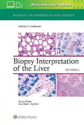 Biopsy Interpretation of the Liver By:Torbenson, Michael Eur:165,84 Ден1:10099