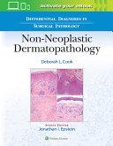 Differential Diagnoses in Surgical Pathology: Non-Neoplastic Dermatopathology By:Cook, Deborah L. Eur:40,63 Ден2:11399