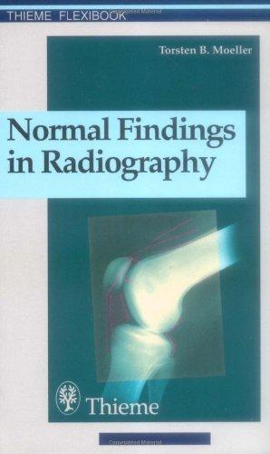 Normal Findings in Radiography : . Zus.-Arb.: Torsten B. Moeller Translated by Terry Telger 190 Illustrations By:Moeller, Torsten Bert Eur:146,33 Ден2:1399