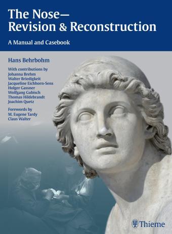 The Nose - Revision and Reconstruction : A Manual and Casebook By:Behrbohm, Hans Eur:325,19 Ден1:6399