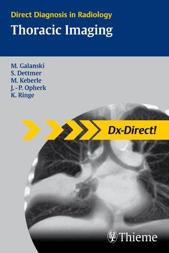 Thoracic Imaging By:Galanski, Michael Eur:336,57 Ден2:2899