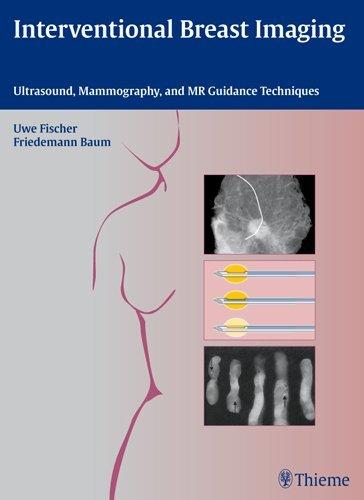 Interventional Breast Imaging By:(MD.), Uwe Fischer Eur:34,13 Ден1:6799