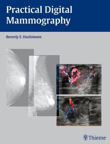 Practical Digital Mammography By:Hashimoto, Beverly Eur:199,98 Ден2:2099