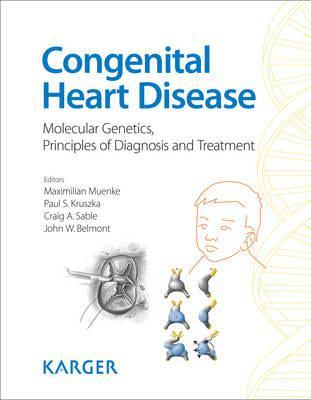 Congenital Heart Disease By:John W Belmont Eur:282,91 Ден1:4599