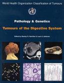 Pathology and Genetics of Tumours of the Digestive System By: Eur:21,12 Ден1:2499