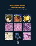 WHO Classification of Tumours of the Eye By: Eur:24,37 Ден1:5099